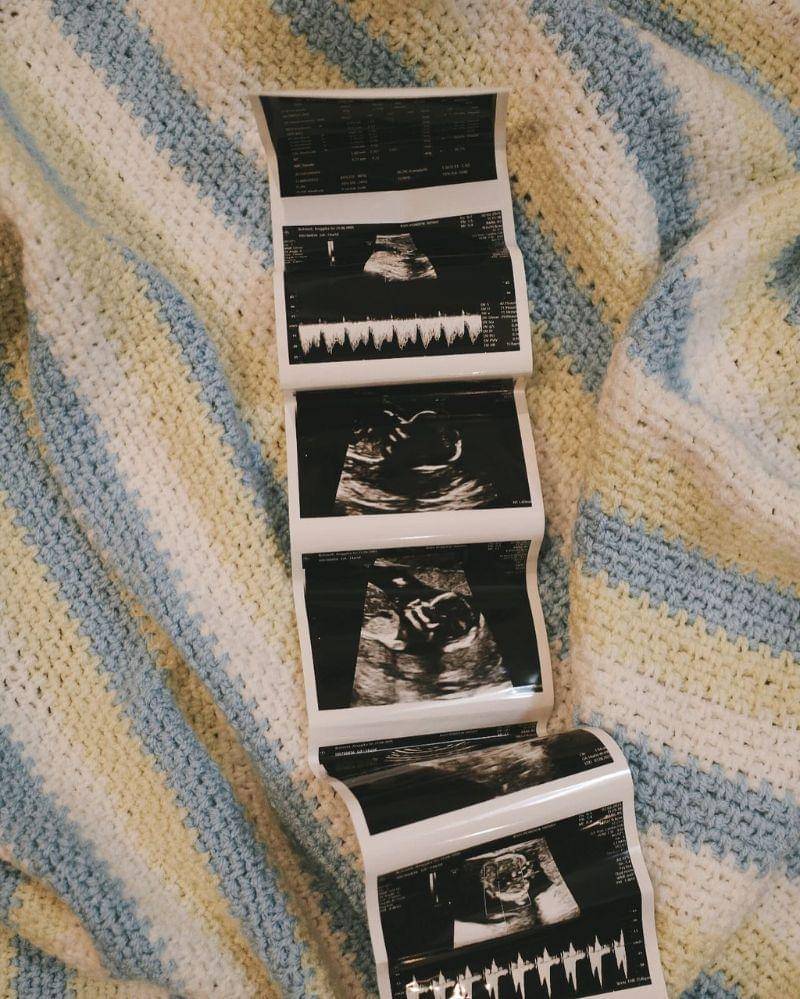 Instagram.com/anggikabolsterli